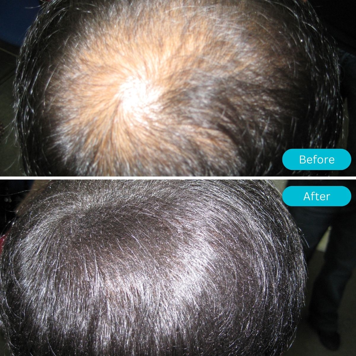 Gruaige Pro Solas blonde