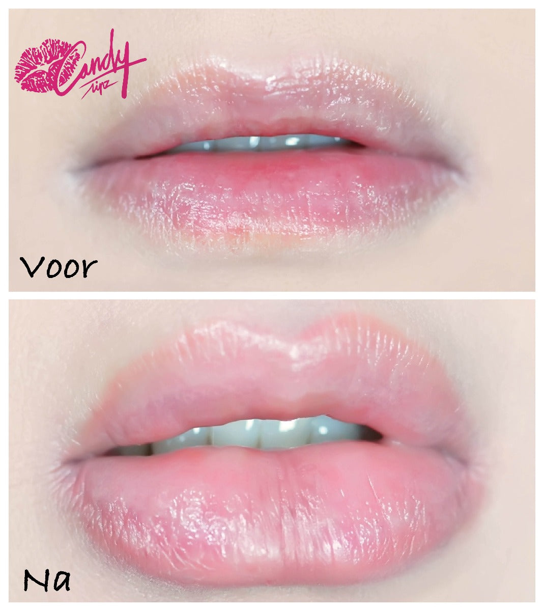 Candylipz - Mini Plumper Green - Podwójne klapki