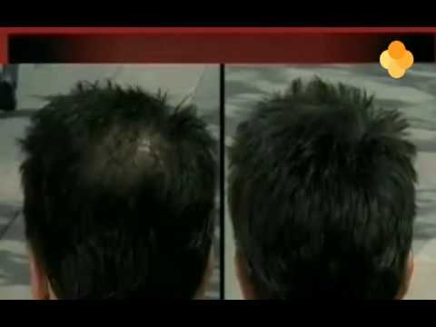 Hair Pro Dark Grey – Vezelpoeder Dat Dunner Haar Direct Voller En Natuurlijk Grijs Laat Lijken