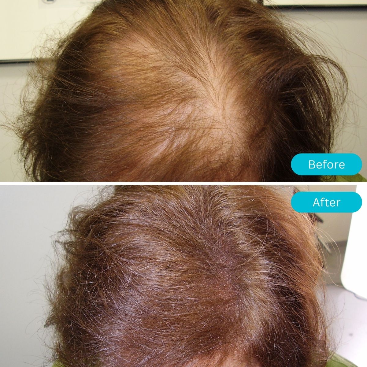 Gruaige Pro Solas blonde