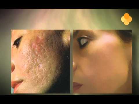 Orange Care - Baba De Caracol Crema Facial 50ml & Crema De Manos 100ml